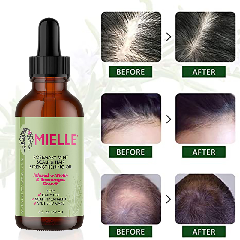 Hair Growth Essential Oil Rosemary Mint Hair Strengthening O - 图0