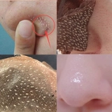 Средство для удаления прыщей от черных точек подходит для мужчин и женщин, отрывная маска для лица, носовые полоски, 30 штук, сужает поры