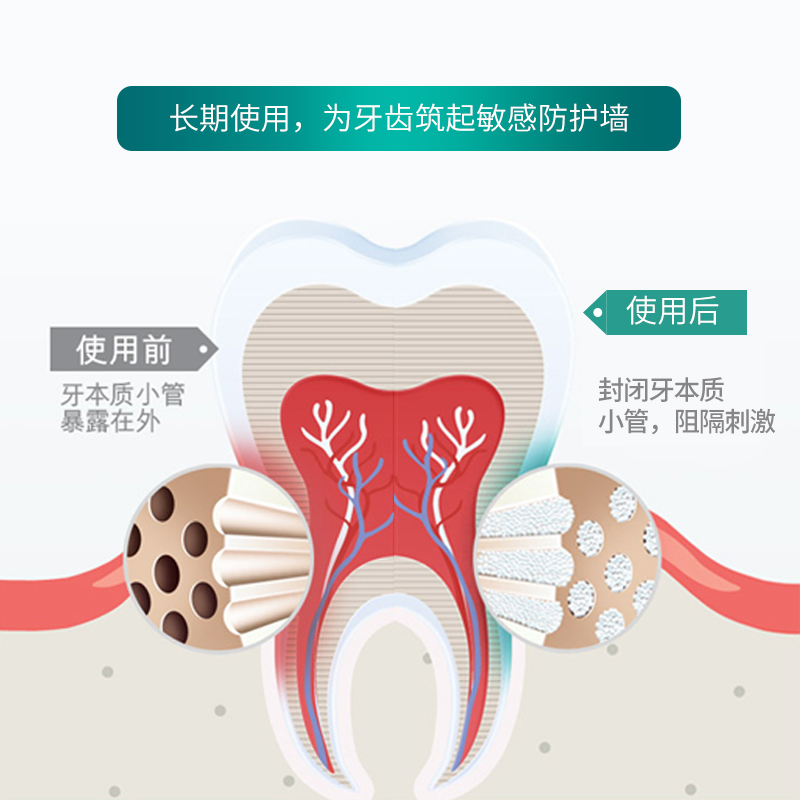 进口瑞士elmex成人专效抗敏防蛀含氟牙膏蛀牙 修复牙釉质 抗敏感