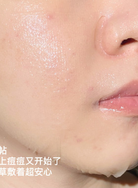 瑷尔博士益生菌保湿熬夜救星面膜
