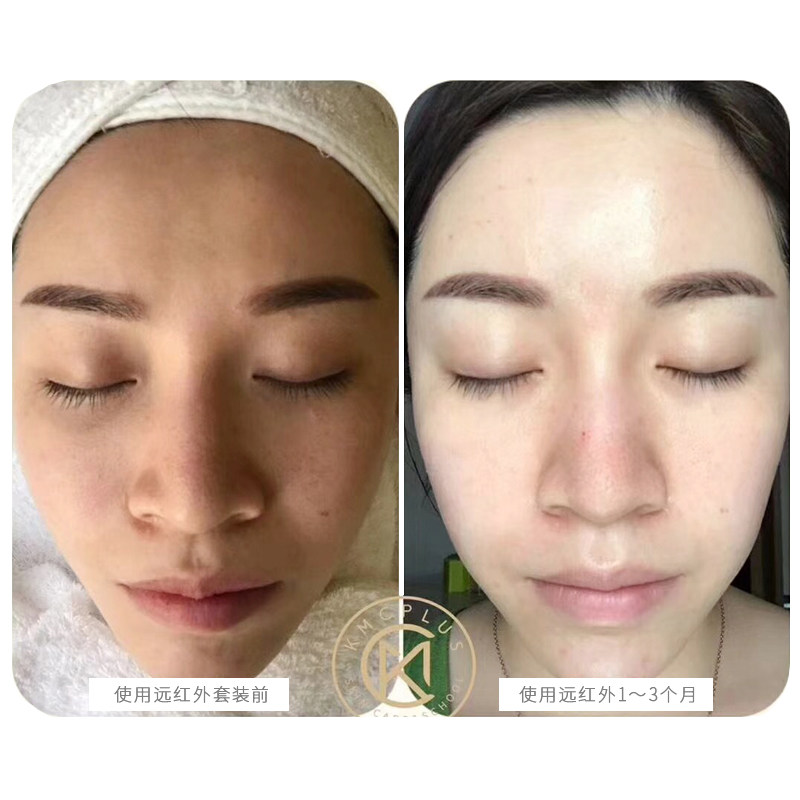 远红外ff鱼子酱hr紧抗明眸焕彩眼霜 KMC护肤精品店眼霜