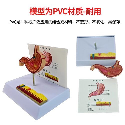人体大肠病理模型 肠胃解剖模型 大肠 盲肠 直肠 十二指肠模型 - 图3