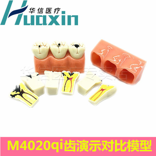 牙齿模型口腔教学假牙模型正畸模牙科种植修复练习乳牙牙齿模型 - 图0