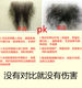 Fake pubic hair for men and women, simulated pubic hair, real effect pubic hair body-fitting hair patch, natural invisible traceless patch
