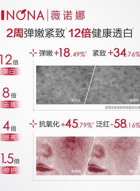 【李永钦专属】薇诺娜「追光相伴」套组修白水乳祛斑精华礼盒套装