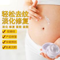 Day Department Pregnancy Print Postpartum Repair Cream Eliminates care tightness Tightness Downplay of Hauteen Obesity Pregnant Women prevention