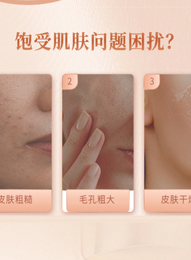 正品签吻芳颜舒缓冰膜顺丰包邮