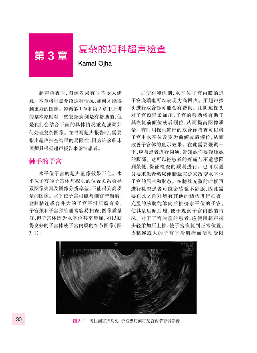 妇科超声检查要点与技巧 黄瑛主译 妇科超声先进技术超声设备报告书写 超声扫查技术疾病诊断 影像学 人民卫生出版社