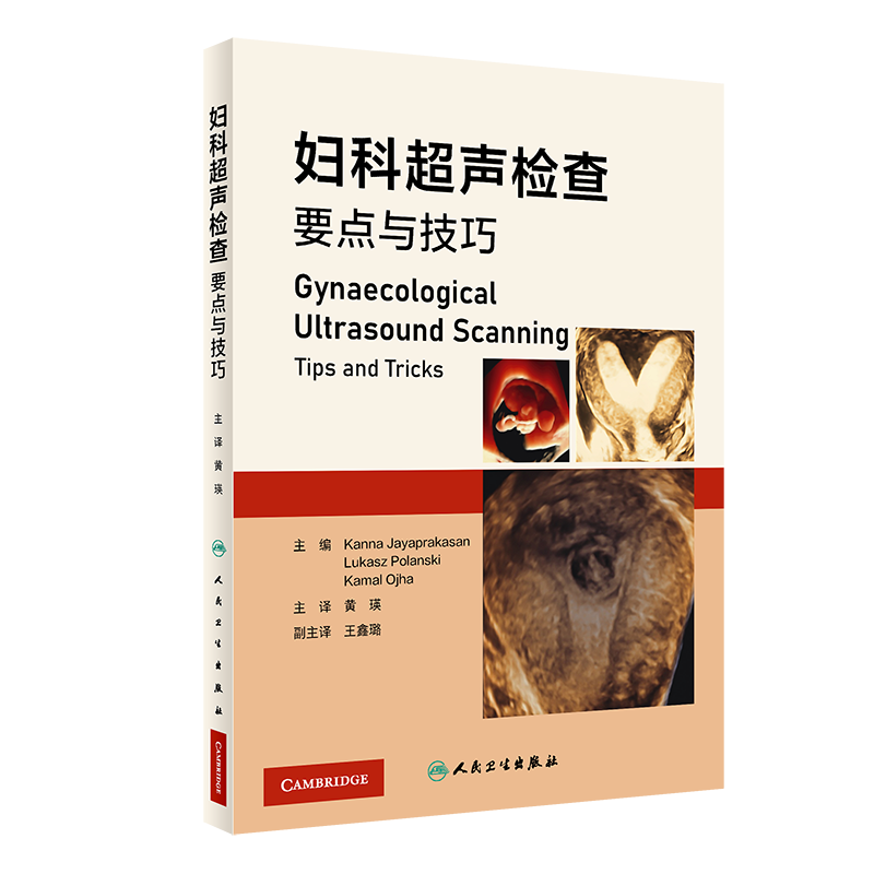 妇科超声检查要点与技巧 黄瑛主译 妇科超声先进技术超声设备报告书写 超声扫查技术疾病诊断 影像学 人民卫生出版社