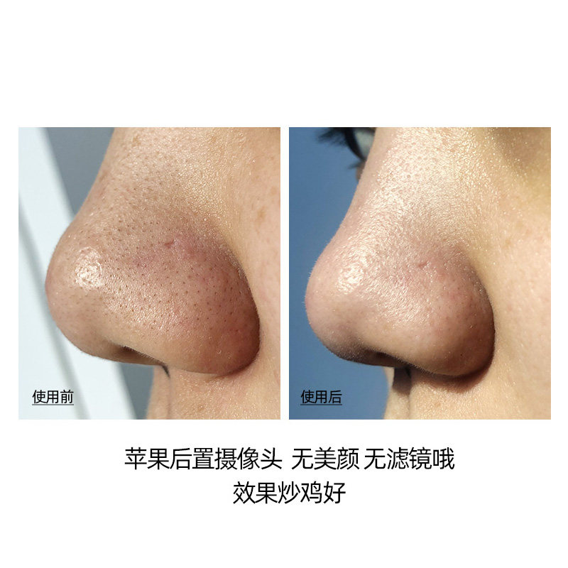 韩国cnp去黑头希恩派紧致导出液 小雪美妆屋鼻帖