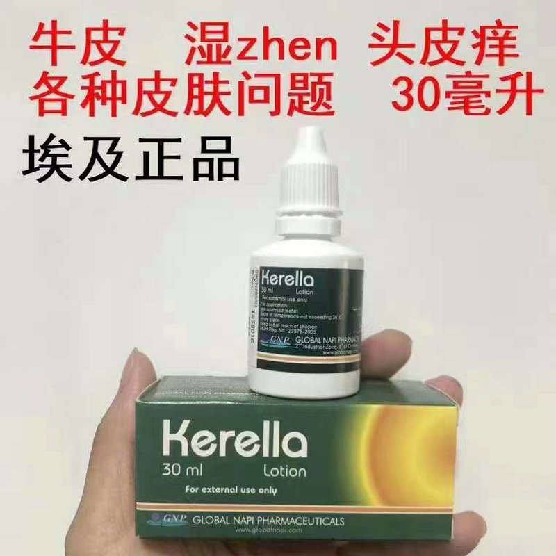 埃及代购kerella头癣搽剂进口牛皮鲜洗剂头痒头皮护理体鲜止痒水 - 图0