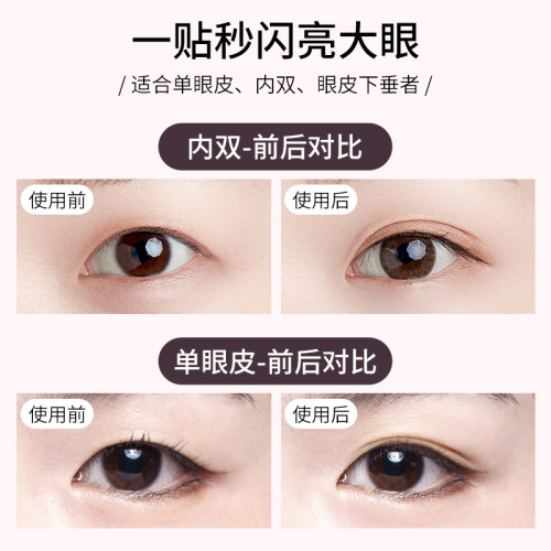 日本LUCKY TRENDY幸尚素肌双眼皮贴女隐形自然无痕肿眼泡专用蕾丝 - 图2