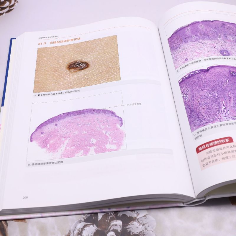 皮肤病理学规培手册-图3