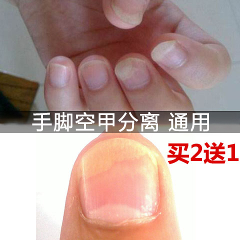 空甲修复甲床分离甲肉分离手指甲肉分离脚甲剥离甲营养不良亮甲油