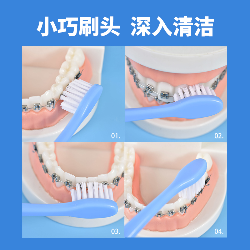 正畸套装清洁牙套专用牙刷矫正牙齿正畸保护蜡牙间刷便携套盒