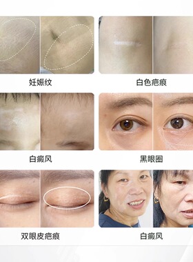 姝蓓尔Sober Skin锦作 肤色遮盖重建色乳料胎记妊娠纹黑眼圈疤痕