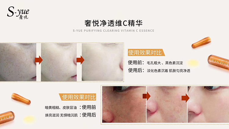 面部美白淡斑提亮膚色安瓶正品妻子 C 精華液祛斑維 VC 奢悅凈透 yue S 面部美白淡斑提亮膚色安瓶正品妻子 C 精華液祛斑維 VC 奢悅凈透 yue S