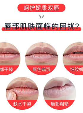 保税仓发vaseline凡士林润唇膏