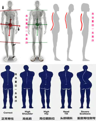 体衡矫正脊柱侧弯驼背骨盆旋转长短腿骨盆倾斜高低肩斜肩矫正鞋垫 - 图2