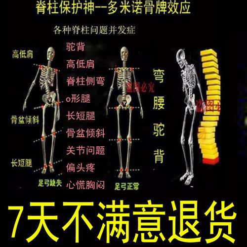 体衡矫正脊柱侧弯驼背骨盆旋转长短腿骨盆倾斜高低肩斜肩矫正鞋垫 - 图1