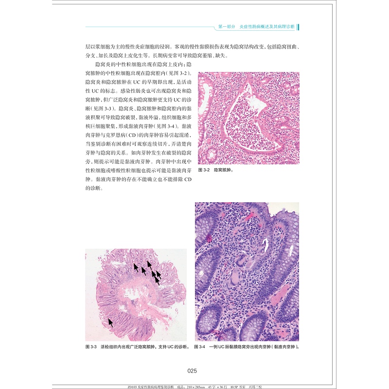 炎症性肠病病理鉴别诊断(精)/炎症性肠病诊断与治疗丛书/肖书渊/姜支农/刘秀丽/浙江大学出版社 - 图1