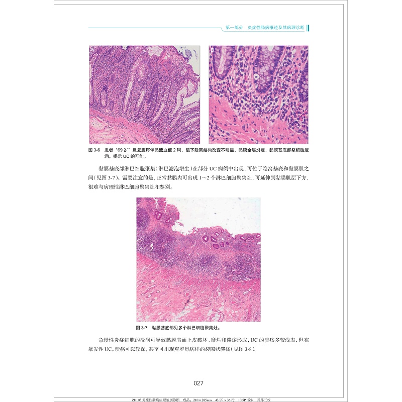 炎症性肠病病理鉴别诊断(精)/炎症性肠病诊断与治疗丛书/肖书渊/姜支农/刘秀丽/浙江大学出版社 - 图3