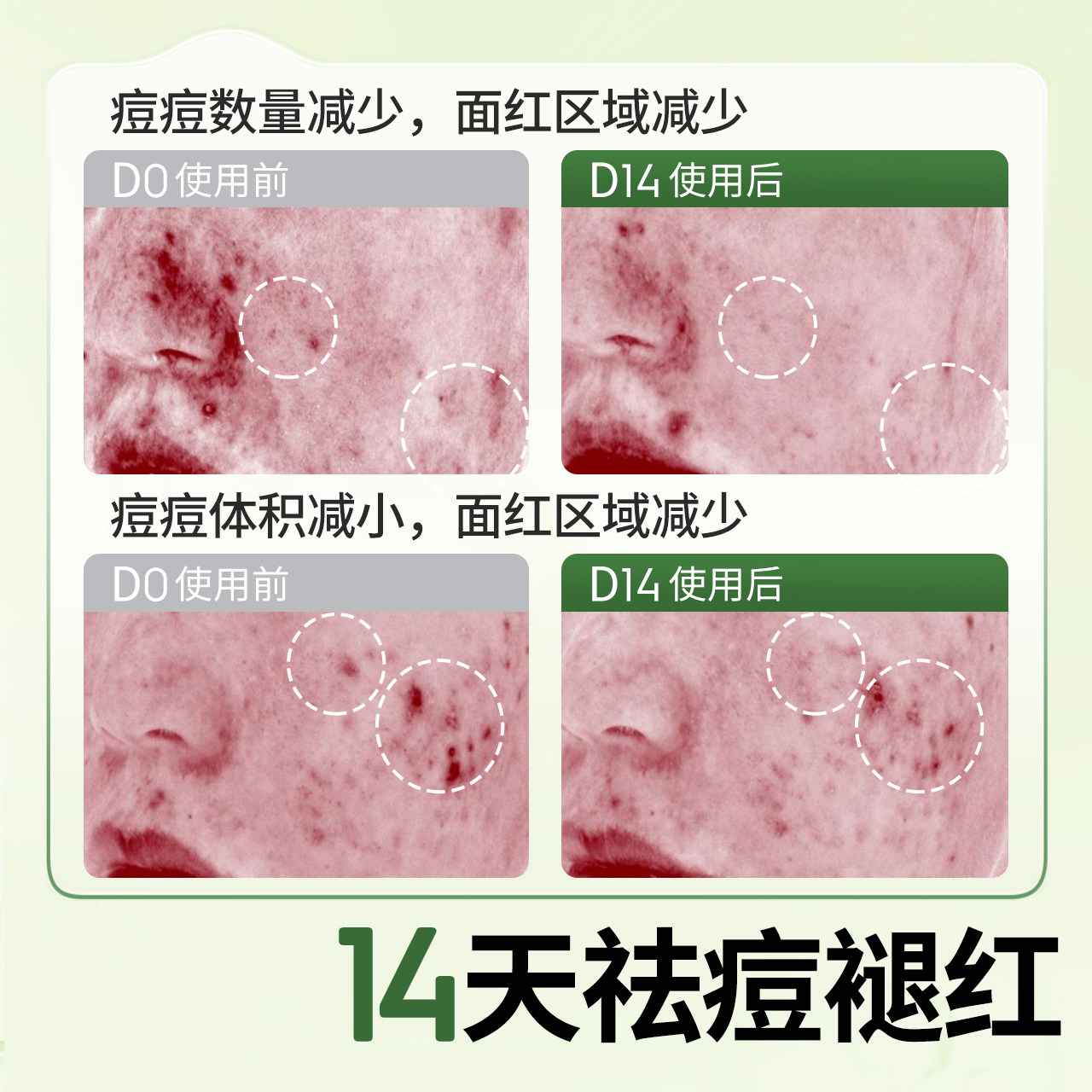 植物妈妈青少年控油祛痘洁面泡沫男女孩学生油痘肌用青春期洗面奶,淘宝优惠券,粉丝福利购,淘宝优惠卷