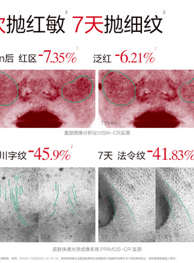 丸美小金针次抛精华液淡纹紧致