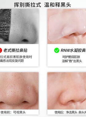 RNW去黑头收缩毛孔清洁鼻贴