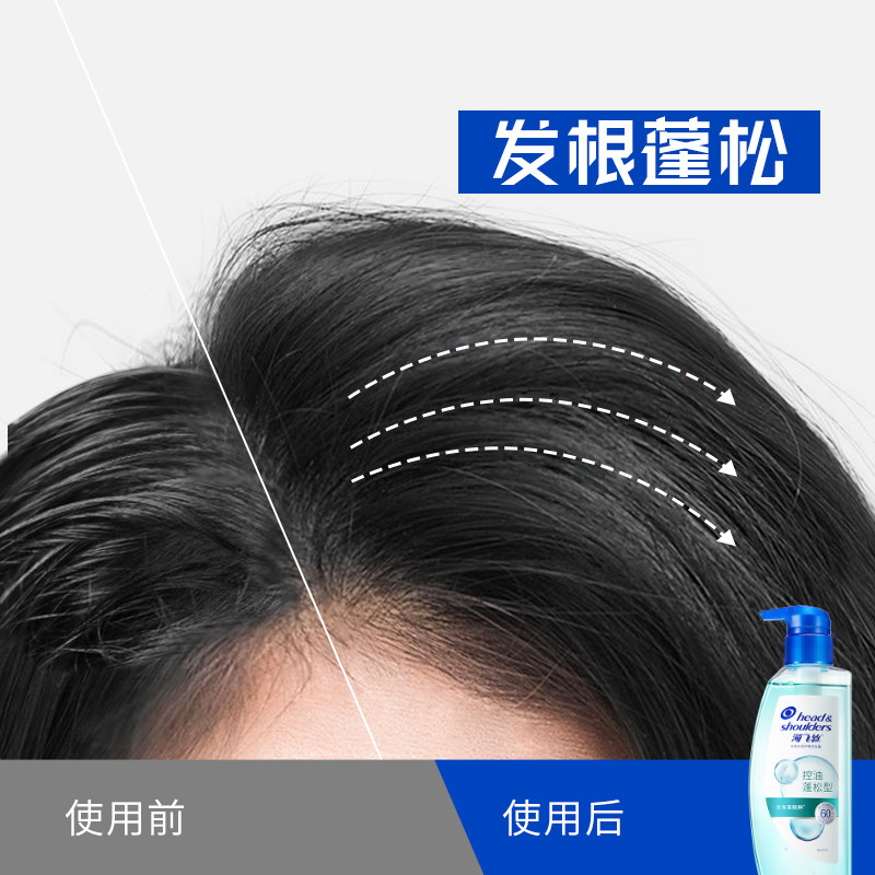 海飞丝去屑头皮护理洗发露 天猫超市洗发水