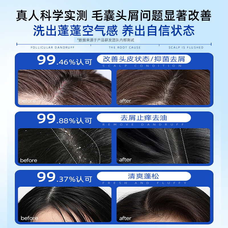 二硫化硒洗发水去头屑控油蓬松止痒女男士毛囊清洁洗发露官方正品