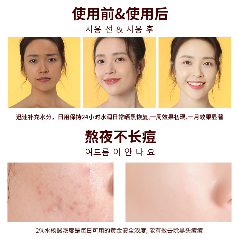 韩国tondi祛痘印痘坑淡化膏消炎芦荟凝胶去痘疤