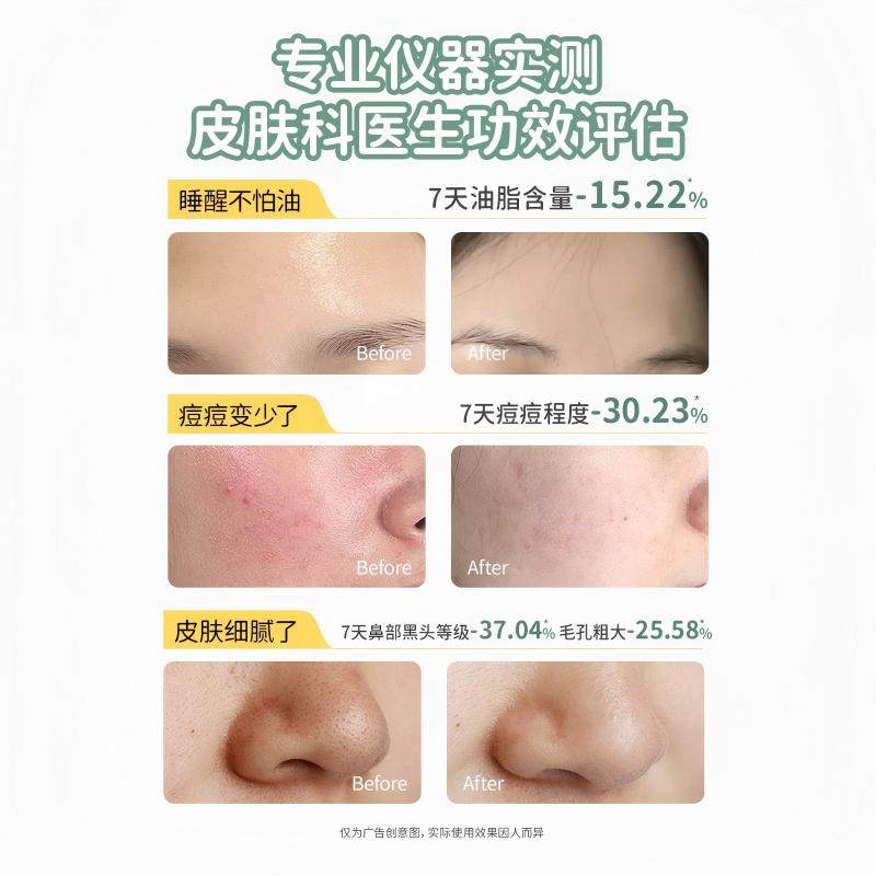 袋鼠妈妈儿童洗面奶青少年青春男女生专用控油洁面乳,淘宝优惠券,粉丝福利购,淘宝优惠卷