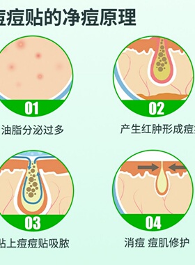 芙雷琳星星痘痘贴舒缓隔离可上妆抗痘贴轻薄透气日夜用遮瑕祛痘贴