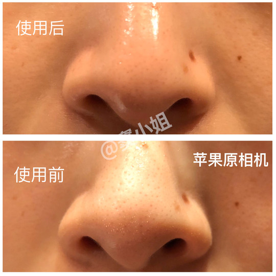 四对整盒！CNP导出黑头鼻贴收缩毛孔非撕拉希恩派男女吸溶解温和