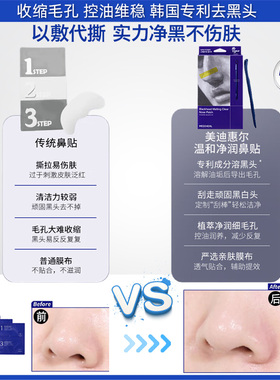 韩国美迪惠尔无痛去黑头白头鼻贴