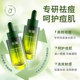 Fupei anti-acne essence fades acne, improves dry acne-prone skin, moisturizes and moisturizes Fupei official product