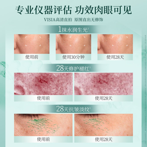 【全新升级】花皙蔻仙人掌胶原水乳套装抗皱淡纹保湿修护舒缓干皮 - 图1