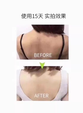 值得拥有~背部皂背后长痘痘美背洗澡后背控油深层清洁除螨手香皂