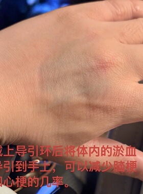 私人定制：苗人福音防辐射氧化石墨烯导引手镯，可选珠子备注留言