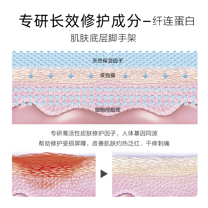 植美村纤连蛋白修护屏障保湿面霜敏感肌舒缓滋润补水秋冬乳霜正品-图1