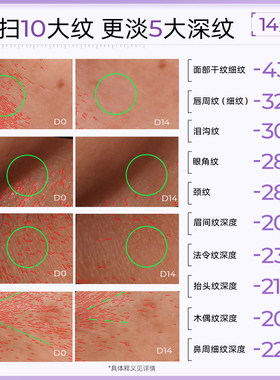 福瑞达颐莲次抛精华保湿紧致