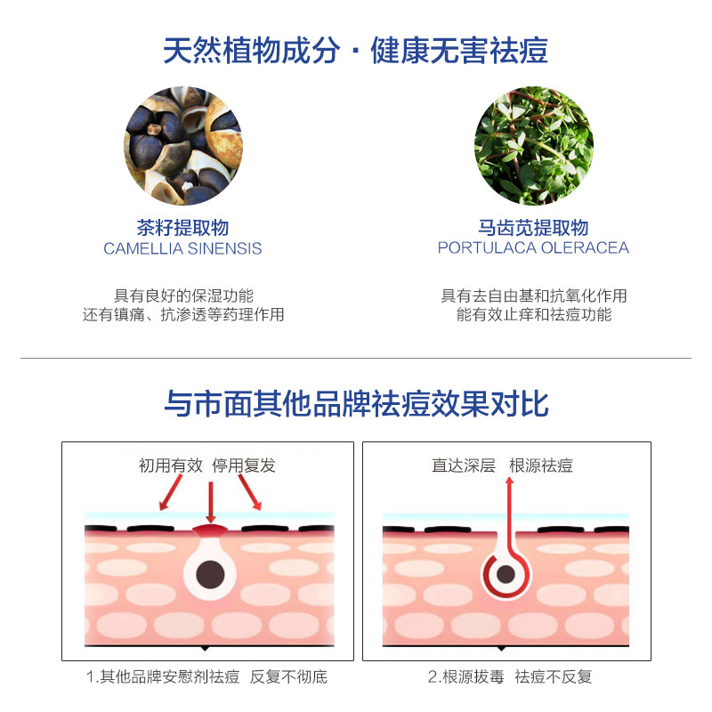 安美拉修护啫喱膏男学生背部祛痘膏 安美拉液态精华