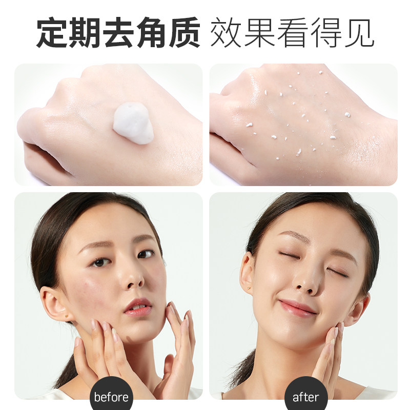 李医生去角质清洁毛孔慕斯脸部鸡皮 李医生百臻面部磨砂/去角质