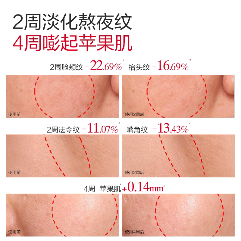 图 4