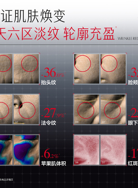 【林依轮双11】丸美小金针绷带霜重组胶原保湿补水修护抗皱