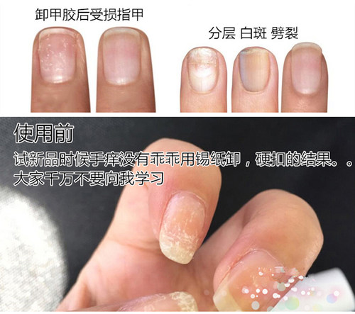 美国CND蛋白急救修复液断裂分层受损护甲美甲营养油指甲护理油 - 图0