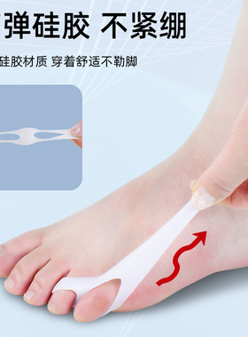 儿童拇指外翻可调节脚趾分趾器