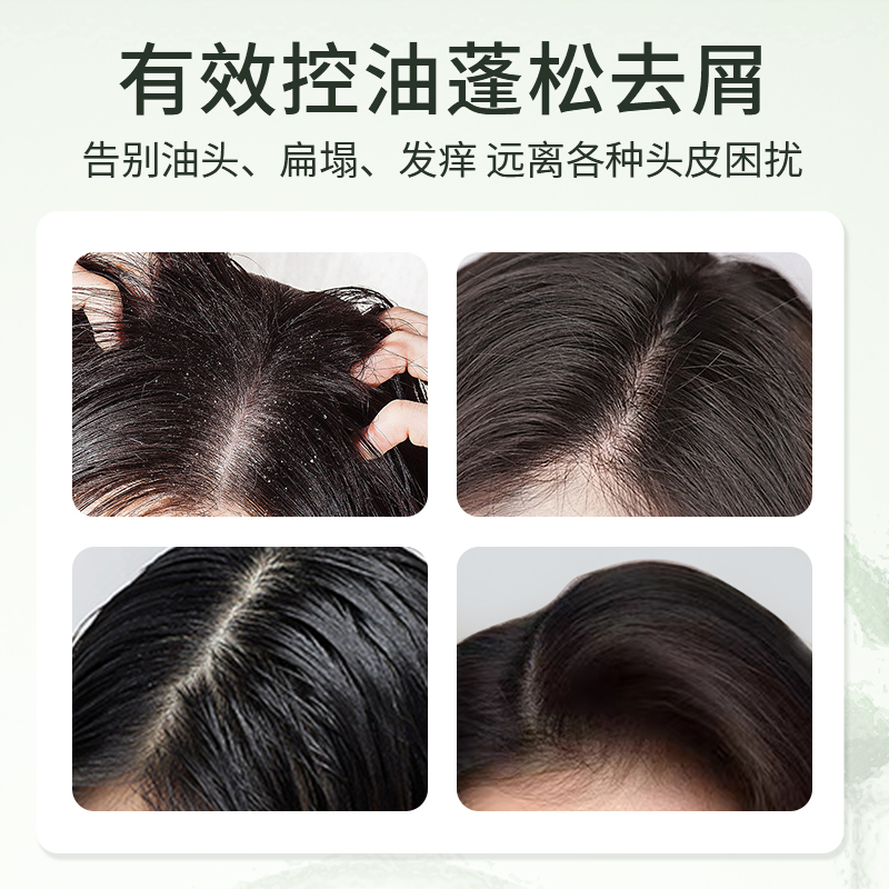 芳馨控油蓬松去屑去痒男女洗发水 芳馨洗发水