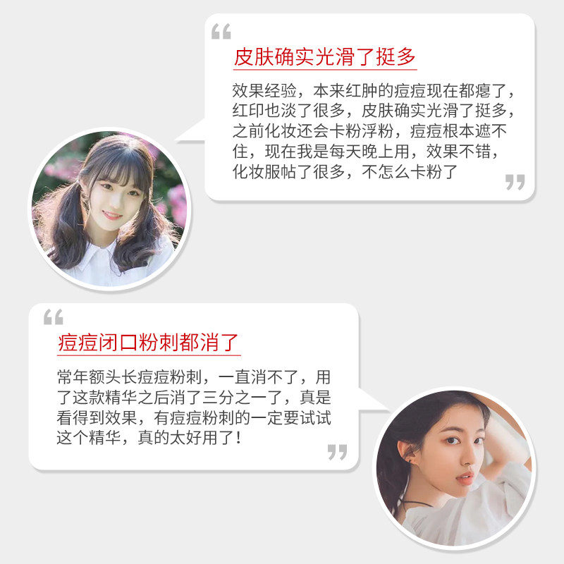 瓷肌30ml女士持久净颜祛痘精华液 瓷肌液态精华